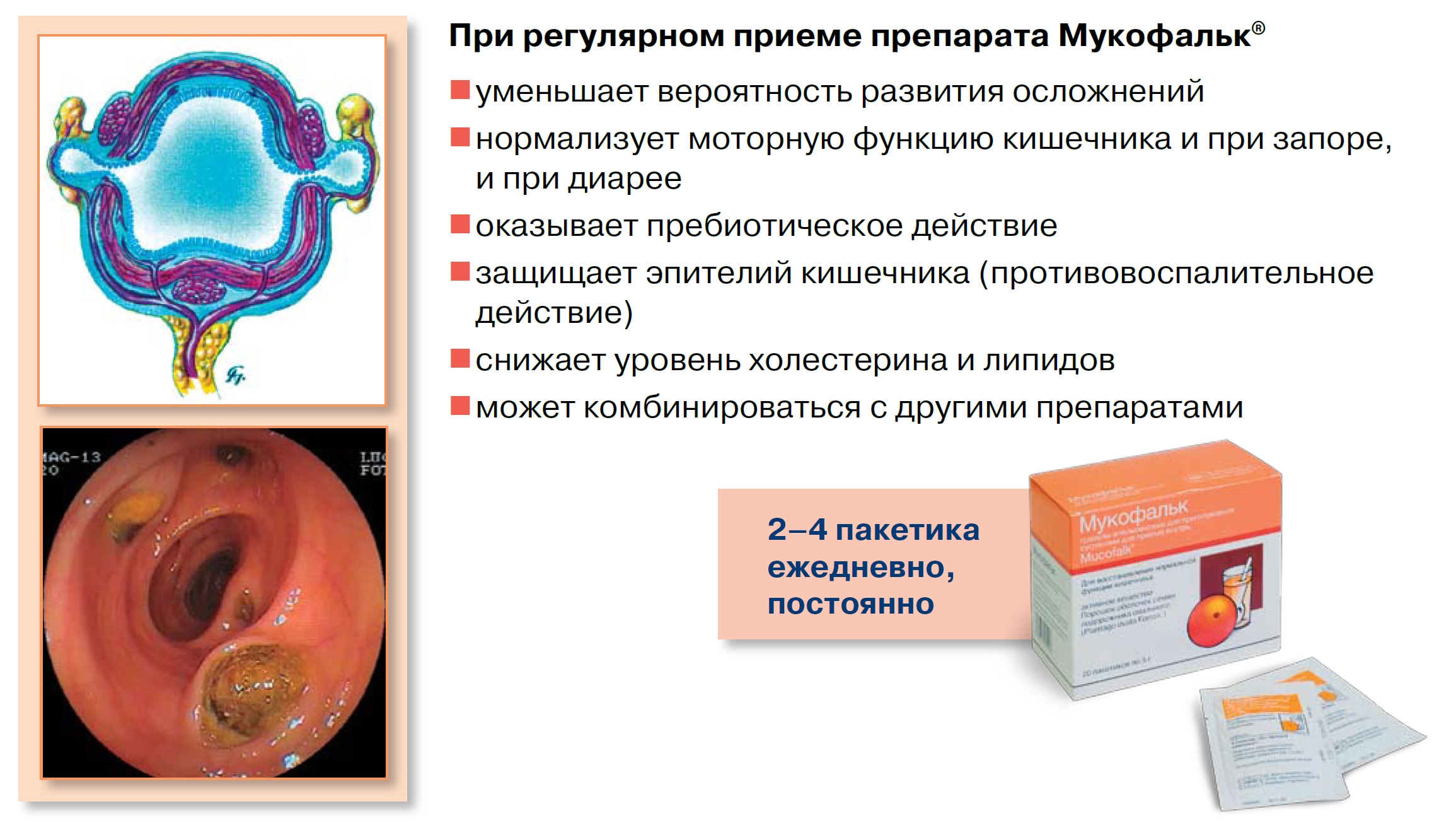 Регулярный примем Мукофалька при дивертикулезе