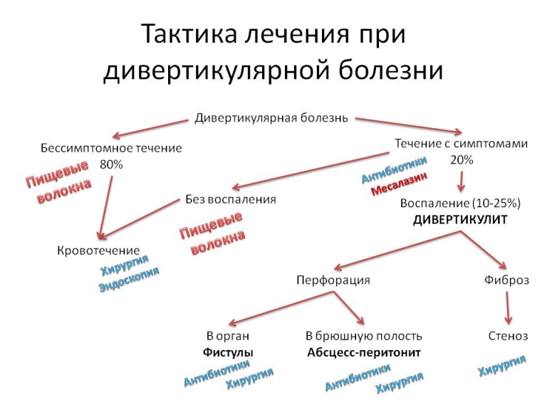 Дивертикулярная болезнь фото